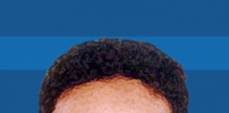 আহত গণতন্ত্র চলছে খুঁড়িয়ে