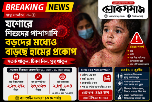 যশোরে বাড়ছে হামের প্রকোপ” শিশুদের পাশাপাশি আক্রান্ত বড়রাও