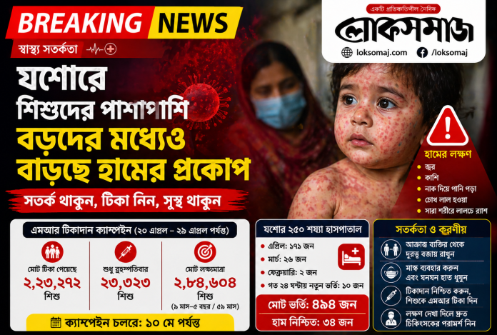 যশোরে বাড়ছে হামের প্রকোপ” শিশুদের পাশাপাশি আক্রান্ত বড়রাও