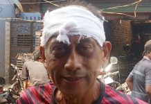 যশোরে হামলার শিকার অভিনেতা সমু চৌধুরী