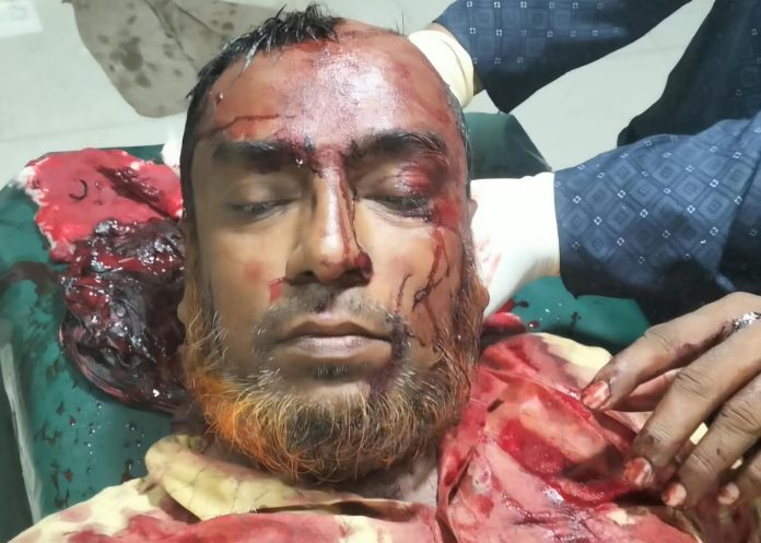 হরিণাকুণ্ডু জমি নিয়ে বিরোধে শ্রমিক দল নেতা কুপিয়ে জখম